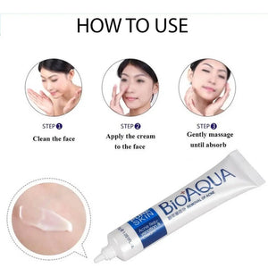 Anti Acne Cream My Store My Store