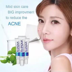 Anti Acne Cream My Store My Store