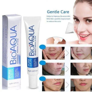 Anti Acne Cream My Store My Store
